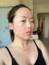 悠伊美醫用冷敷型膠原蛋面膜術(shù)后曬后敏感肌修護肌膚祛紅腫去痘痘肌女  三盒15片 曬單實(shí)拍圖