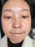 南京同仁堂祛痘膏去痘痘和痘印痘坑修復男女士改善粉刺閉口30g 曬單實拍圖