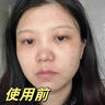 韓方五谷377美白補水保濕精華液次拋祛斑提亮去黃護膚品抗氧煙酰胺男女士 曬單實(shí)拍圖