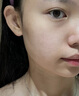 維特絲祛痘藥膏50g壬二酸水楊酸去痘痘和收毛孔閉口粉刺男女精華 曬單實(shí)拍圖