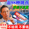 胖東來(lái)美白祛斑霜強(qiáng)效第1名100%淡化老年黃褐雀斑黑色素一夜消專(zhuān)用的藥 2025新科技 男女醫(yī)用【1支裝】 曬單實(shí)拍圖