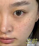 透真377美白祛斑護膚品套裝 去黃淡斑提亮3577水乳淡化黑色素痘印曬斑 曬單實(shí)拍圖