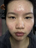 南京同仁堂祛痘膏去痘痘和痘印痘坑修復(fù)男女士改善粉刺閉口30g 曬單實拍圖