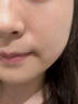 維特絲壬二酸祛痘藥膏去痘痘粉刺閉口收毛孔男女煙酰胺水楊酸青少年凝膠 曬單實(shí)拍圖