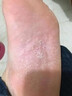 腳氣噴劑止癢脫皮爛腳丫真菌感染水泡腳爛足男女通用汗腳腳癢草本臭腳趾縫皮溫和不刺激臭出汗正品非藥噴霧 1瓶裝【60ml】 曬單實(shí)拍圖