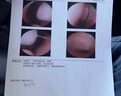 嘴巴呼吸矯正貼閉口兒童防張嘴睡覺(jué)神器腺樣體肥大醫用中藥貼打呼 一盒裝【睡覺(jué)張嘴】 曬單實(shí)拍圖