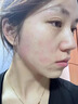 Newliann醫(yī)用重組三型人源化膠原蛋白乳液修復(fù)敷料凝膠人表皮生長因子面霜 曬單實拍圖