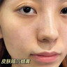 儒意（RUYI）377美白面膜補(bǔ)水男士保濕淡斑提亮膚色女抗皺緊致抗衰老去黃第1名 曬單實(shí)拍圖