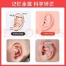 齊琛醫(yī)生嬰兒耳朵矯正器新生兒童愛美耳夾硅膠耳廓貼非耳朵矯正器耳型 24年新款納米硅膠單耳耳夾 曬單實拍圖