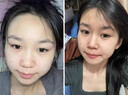 奇動(dòng)力葡萄籽原花青素軟膠囊奇動(dòng)力VCVE+片抗氧化補(bǔ)充VCVE膠原蛋白淡斑 【葡萄籽+維C維E】組合裝 曬單實(shí)拍圖