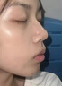 Losoki瑞士進口祛痘藥膏50g 祛痘痘和痘印淡化修復痘坑青春痘專用精華 曬單實拍圖