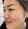 璣麗可【璣麗可面膜】機麗可祛斑美白璣麗珂去黃璣力可提亮國妝特征 面膜*1盒（建議買多盒 更劃算） 曬單實拍圖