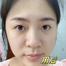 Losoki瑞士進(jìn)口377面膜美白補(bǔ)水淡斑提亮膚色女男士抗皺緊致抗衰老熬夜 曬單實(shí)拍圖