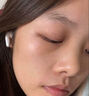 滬徑制藥去痣點(diǎn)痣膏祛痣點(diǎn)痣點(diǎn)疣藥水點(diǎn)痣醫用專(zhuān)用官方正品黑痣臉部不留疤 曬單實(shí)拍圖