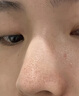 維特絲去黑頭鼻貼10組20片免撕拉面膜導(dǎo)出液收縮毛孔清潔粉刺神器男女士 曬單實(shí)拍圖