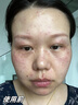 片仔癀美白淡斑套裝淡化黑色素老年黃褐雀斑曬斑提亮去黃祛斑霜護(hù)膚品女 四件套【水+乳+精華+祛斑霜】 曬單實(shí)拍圖