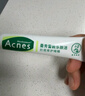 曼秀雷敦（Mentholatum）痘痘貼搭檔 樂膚潔清痘凝膠控油保濕修護(hù)痘肌 抗痘護(hù)理啫喱18g 曬單實(shí)拍圖