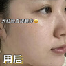 奈皙日本曬后修復急救皮膚屏障受損泛紅積雪草曬傷藥膏男士醫(yī)美用煥白 曬單實拍圖
