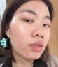 OHBT壬二酸凈膚凝膠30g控油改善痘痘痘肌消除臉上坑洼印子 曬單實(shí)拍圖