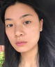 維特絲壬二酸祛痘藥膏煙酰胺凝膠去痘痘粉刺閉口男女水楊酸收毛孔青少年 曬單實(shí)拍圖