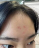 南京同仁堂美白祛斑霜美白淡化老年黃褐雀斑黑色素修護淡化細(xì)紋男女士50g 曬單實拍圖