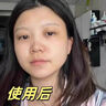 韓方五谷377美白補水保濕精華液次拋祛斑提亮去黃護膚品抗氧煙酰胺男女士 曬單實(shí)拍圖