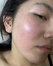 MOIHANR德國面膜醫用械字號冷敷貼醫美術(shù)后修復保濕補水曬后修復敏感皮膚 【術(shù)后修復補水】三盒裝 曬單實(shí)拍圖
