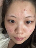 Newliann醫(yī)用械字號洗面奶狀潔面乳控油祛痘除螨蟲去黑頭男士女士修復屏障 曬單實拍圖