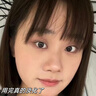 宋美人 SMREN法令紋貼法令紋去除神器貼提拉緊致睡覺(jué)專用去嘴角八字紋 曬單實(shí)拍圖