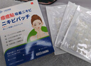 守誠堂制藥日本醫(yī)用祛痘痘貼消炎吸膿淡化遮瑕痘痘印貼隱形輕薄 曬單實拍圖