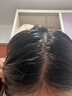 川廿制藥生發(fā)液激活毛囊增發(fā)密發(fā)長(cháng)發(fā)劑育發(fā)液固發(fā)液防脫發(fā)嚴重男女士專(zhuān)用 曬單實(shí)拍圖