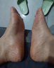 云南本草腳氣白藥真菌感染止癢殺抑菌特效腳氣腳癢藥膏店水泡爛脫皮噴霧劑 買(mǎi)2發(fā)3【一噴見(jiàn)效】腳丫足部專(zhuān)用 去的噴根治后跟開(kāi)裂療臭真菌王手癬 曬單實(shí)拍圖