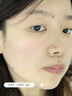 滬徑制藥去痣點(diǎn)痣膏祛痣點(diǎn)痣點(diǎn)疣藥水點(diǎn)痣醫用專(zhuān)用官方正品黑痣臉部不留疤 曬單實(shí)拍圖