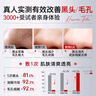 kuvive新加坡進(jìn)口清潔面膜去黑頭泥膜祛痘粉刺閉口涂抹式收縮毛孔男女士 【周期清潔0毛孔】去黑頭泥膜2瓶 曬單實(shí)拍圖