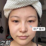焦博士日本眼膜眼袋貼提拉緊致抗皺淡化細(xì)紋黑眼圈去眼貼膜眼袋眼紋專用 曬單實(shí)拍圖