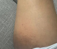 皇元妙醫(yī)股蘚癬膏大腿內(nèi)側(cè)真菌感染腹股溝股癬膏瘙癢藥紅疹越抓越癢噴霧劑 20g 5盒 【好后不犯】買3發(fā)5 曬單實拍圖