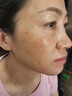 萊覽奧蓋祛斑霜祛斑黃褐斑雀斑曬斑男女士用的純中藥老年斑專(zhuān)用非藥一夜消 特效：拍1發(fā)3【日本原裝進(jìn)口】 醫用正品美白淡化黑色素老人斑臉部手背效果最好純中藥 曬單實(shí)拍圖