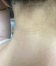 黑色素去除沉淀治黑棘皮病癥藥膏專(zhuān)用男女肥胖胳膊肘腋下神器 【黑色素去除】*1盒 只售正品 曬單實(shí)拍圖