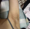 喬記腋下黑色素去除胳肢窩美白脖子腋下大腿內側黑棘皮病去除非藥乳膏 買(mǎi)2送1凈化素【吸走黑色素】可試用 私處粉嫩淡化黑色素黑棘皮病輔助治療脖子黑色素膏藥 曬單實(shí)拍圖