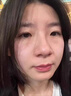 鑫博士點痣膏藥水去痣點疣無痕臉部不留疤黑痣扁平疣瘊男女士專用修復(fù)液 曬單實拍圖