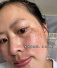 焦博士日本377祛斑霜美白淡化老年黃褐雀斑黑色素熊果苷乳膏去曬男女士 曬單實(shí)拍圖