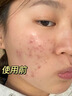 dyey茶泥清潔面膜去黑頭泥膜閉口收縮毛孔補水提亮膚色涂抹深層清潔 茶泥面膜【1瓶】 曬單實拍圖