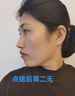 FLYMAN點痣膏醫(yī)用專用官方正品去痣(藥監(jiān)備案)無痛無痕臉部不留疤祛痣膏 1盒【點痣膏+修復液】痣準掉 點斑點疣水美容院專用疤痕修復祛斑雀斑老年斑潤膚 曬單實拍圖
