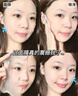 儒意（RUYI）377美白面膜補水男女士保濕淡斑提亮膚色抗皺緊致抗衰老去黃金榜 曬單實(shí)拍圖