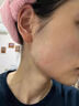 Andwarm原裝進口曬后修復(fù)凝膠女男士兒童面部肌膚膏臉曬傷修復(fù)補水蘆薈膠 100ml【緊急舒緩修護】 曬單實拍圖