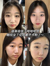 焦博士日本眼霜去眼袋消除重度眼袋專(zhuān)用女男士淡化細紋提拉緊致黑眼圈除 曬單實(shí)拍圖