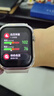 華為（HUAWEI）手表WATCH D2【咨詢(xún)享優(yōu)惠】腕部心電血壓采集記錄儀家用血氧睡眠壓力體溫監測運動(dòng)健康家人禮物 晨曦金【送保護膜+曬單十選一】 曬單實(shí)拍圖