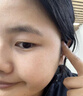YYTISS377祛斑美白淡斑淡化黑色素藥霜黃褐斑雀斑曬斑女煙酰胺男士專(zhuān)用 曬單實(shí)拍圖