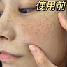 儒意（RUYI）377美白面膜補(bǔ)水男女士保濕淡斑提亮膚色抗皺緊致抗衰老去黃金榜 曬單實(shí)拍圖