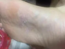CNDK外用腳臭腳汽腳輕松噴霧劑足部腳癢水泡脫皮糜爛腳汗男女通用溫和 今日活動【強效款-2盒療城裝】 曬單實拍圖